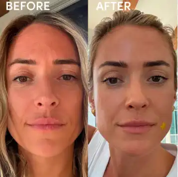 glutathione-for-anti-aging