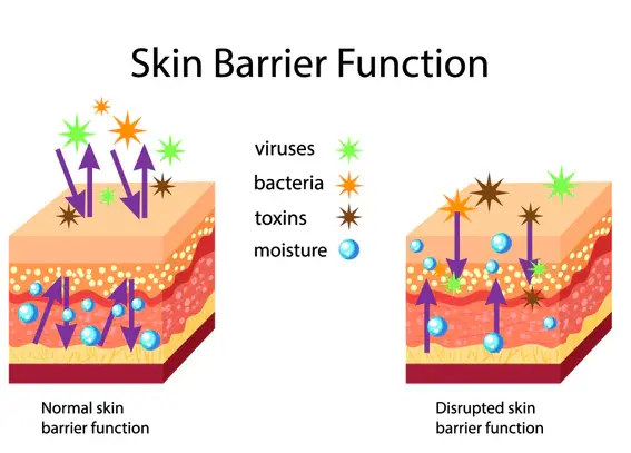 skin barrier