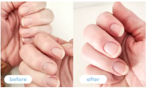 Haylee T. - Taking Premium Collagen Peptides for 4 weeks – The Collagen Co NZ Haylee T. - Taking Premium Collagen Peptides for 4 weeks – The Collagen Co NZ