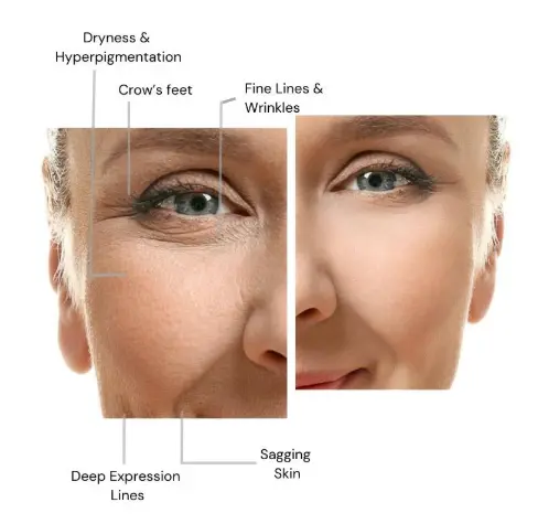 Bioscience Peptide Complex Anti-Aging Serum Bioscience Peptide Complex Anti-Aging Serum