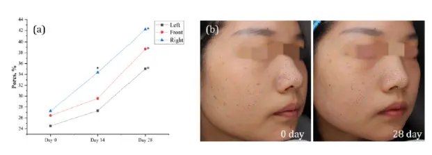 Efficacy of Oral Administration of Ergothioneine (DR. ERGO<sup>™</sup>) on Skin Health Improvement: A Single-Center, Open-Label Clinical Study Efficacy of Oral Administration of Ergothioneine (DR. ERGO<sup>™</sup>) on Skin Health Improvement: A Single-Center, Open-Label Clinical Study