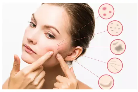 15 Best Benefits Of Beta Carotene For Skin, Hair And Health